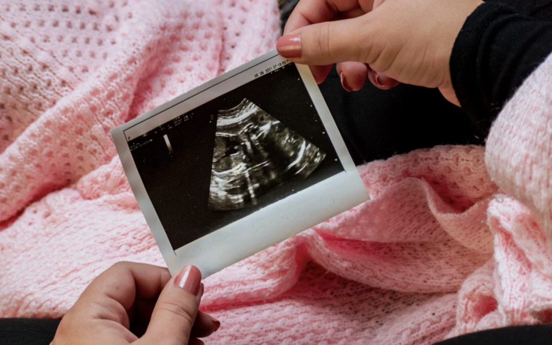 Woman's hands holding ultrasound picture