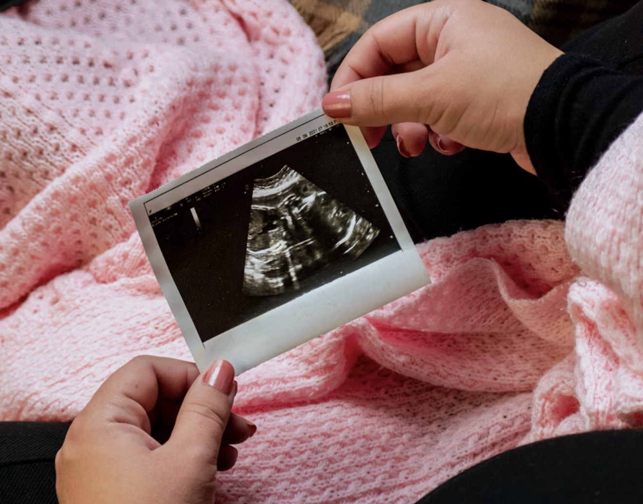 Woman's hands holding ultrasound picture